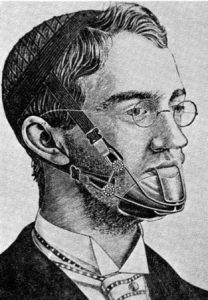 Orthodontics Has Come A Long Way In 50,000 Years