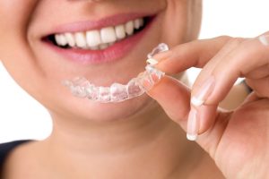 Orthodontic retainers